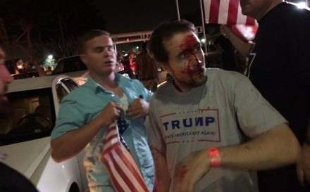 Trump-Supporter-Bloodied-Pearce-Twitter-575x431.jpg
